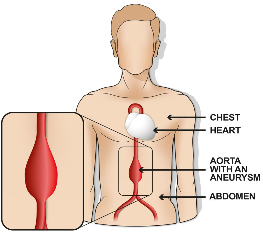 a diagram showing the aorta