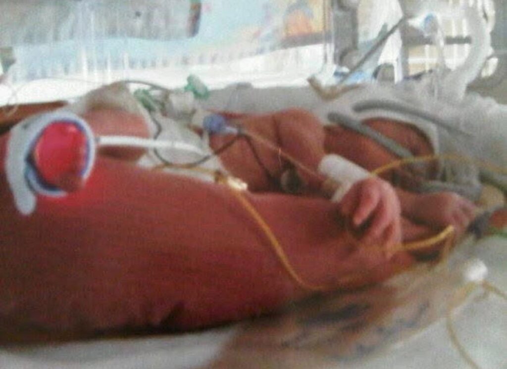Lacey was cared for on the unit after being born at 28 weeks