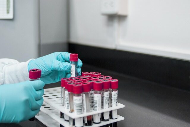 A gloved hand sorts out vials, used in laboratory testing